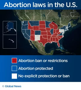 Abortion laws in each state