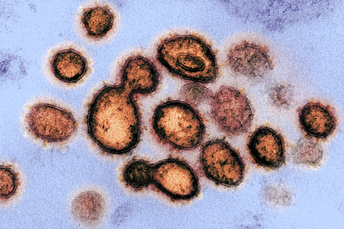 Novel+Coronavirus+SARS-CoV-2%C2%96This+scanning+electron+microscope+image+shows+SARS-CoV-2%C2%97also+known+as+2019-nCoV%2C+the+virus+that+causes+COVID-19.++Original+image+sourced+from+US+Government+department%3A+The+National+Institute+of+Allergy+and+Infectious+Diseases.+Under+US+law+this+image+is+copyright+free%2C+please+credit+the+government+department+whenever+you+can%C2%94.